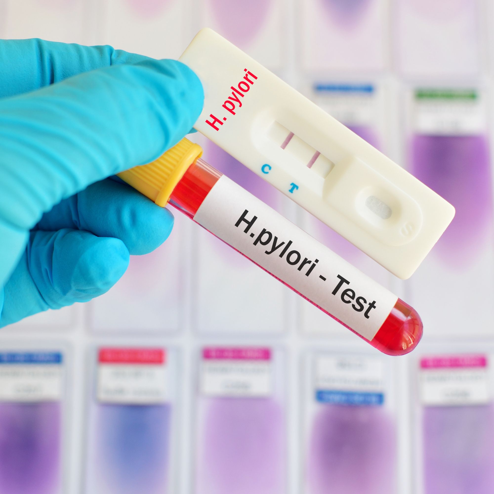 Helicobacter pylori Test